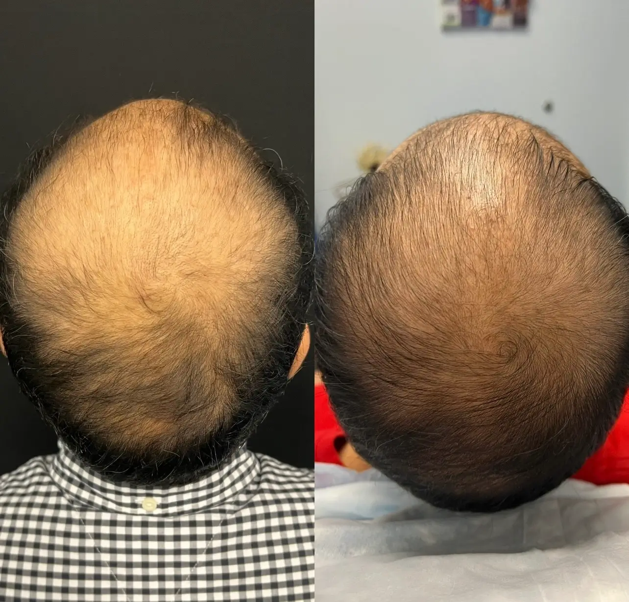 Rejuve Med-Spa Gallery After Image at Dallas & Plano