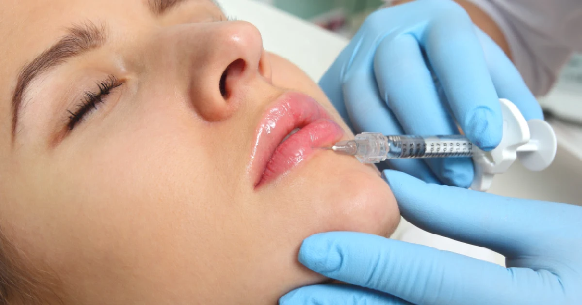 woman receiving a lip filler injection in North Dallas