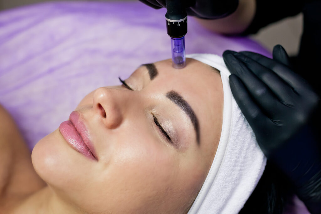 Does Microdermabrasion Come With Any Downtime? Rejuve MedSpa