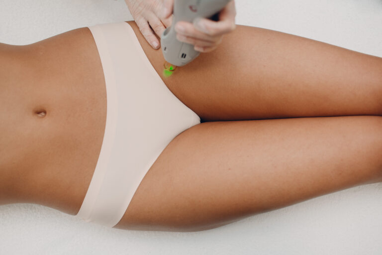 How To Prepare for Laser Hair Removal