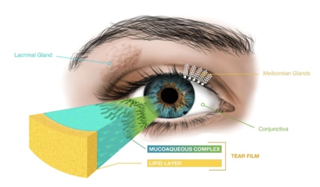 Lipiflow Dry Eye Treatment Edmonton and Northern Alberta