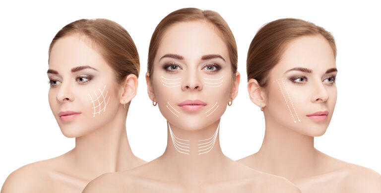 How Long Will Kybella® Last?