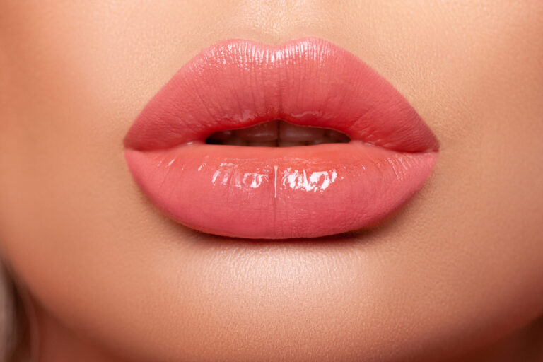 Volbella: Plump Lips and Line Correction