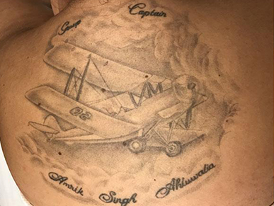 Laser Tattoo Removal Dallas