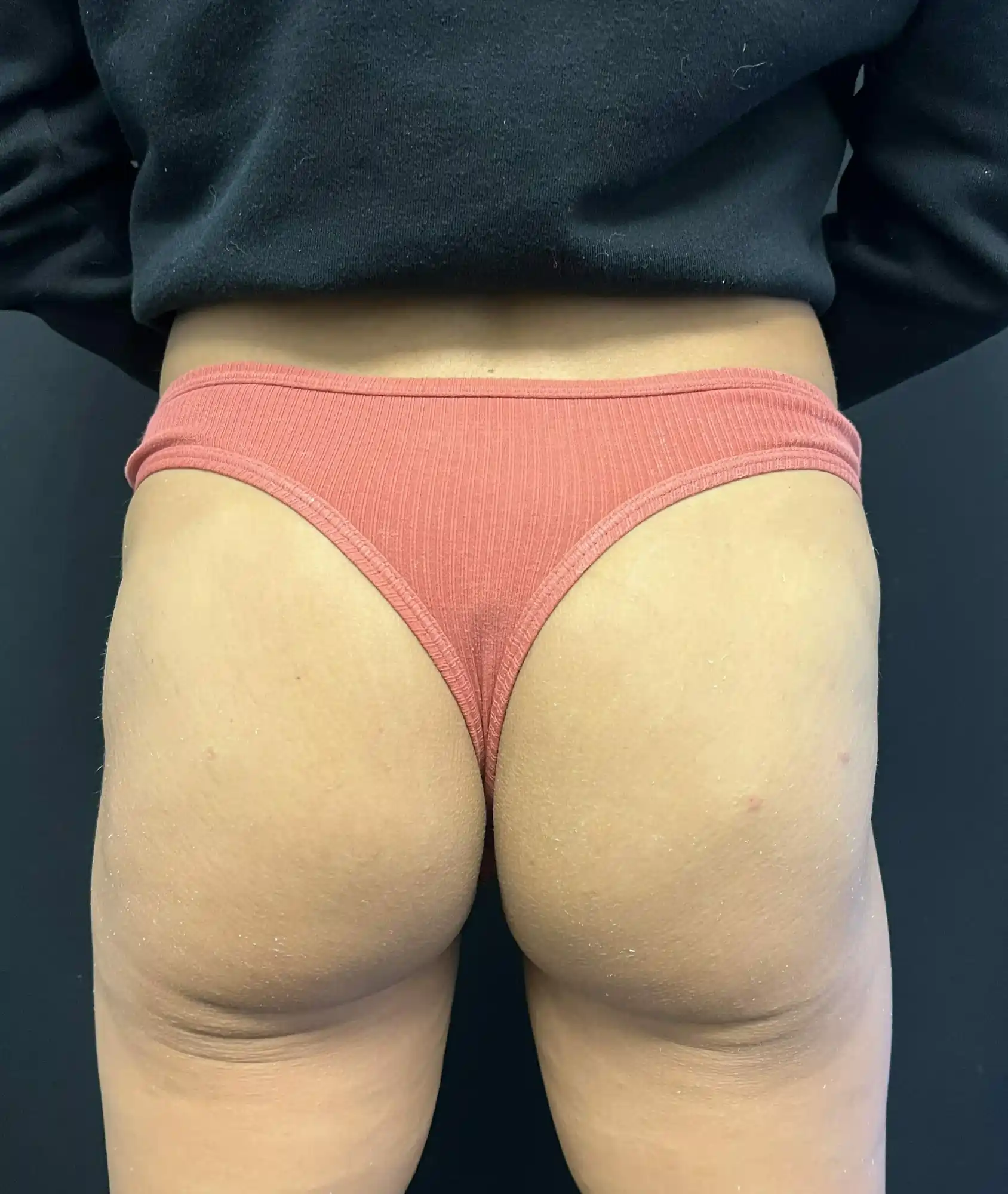 Before & After Treatment Images in Dallas, TX