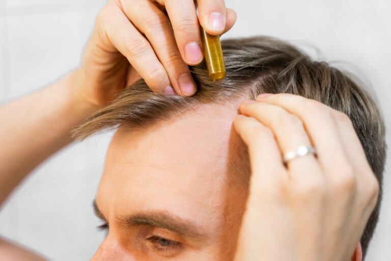 Am I a Candidate for PRP Hair Restoration?