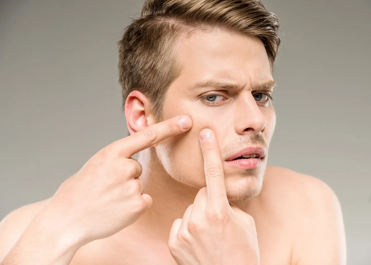 Man pointing to cheek showing skin concern