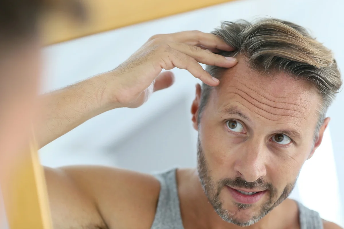 Man checking hairline and scalp health
