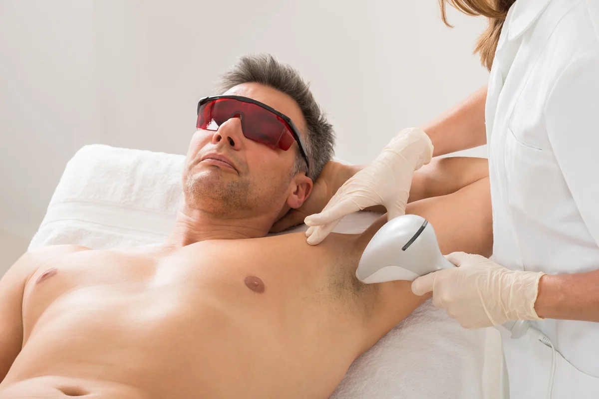 Laser skin treatment on male chest area