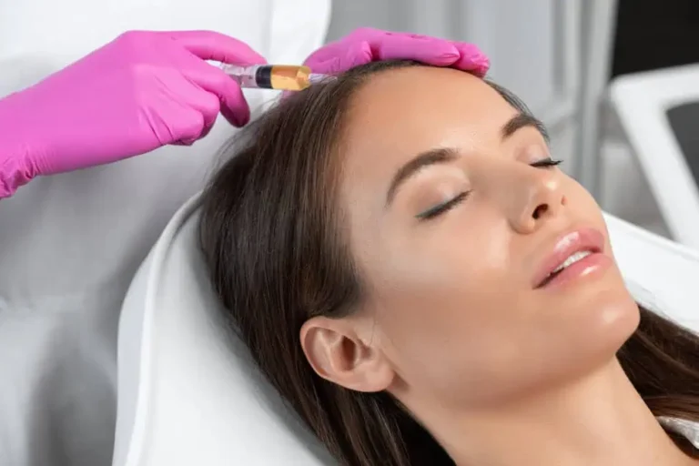 PRP treatment for acne scars and texture